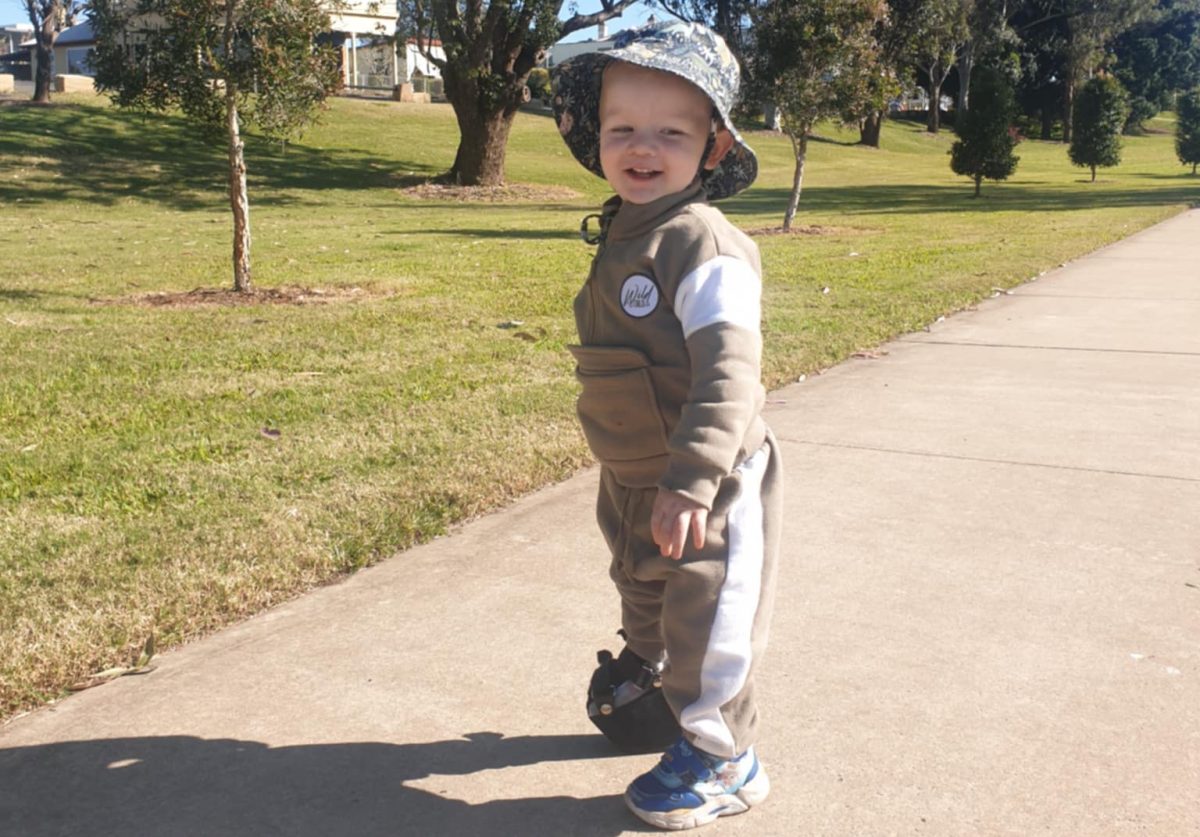 A toddler with Congenital Femoral Deficiency smiles at the park