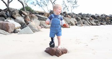 Little Henry's big challenge: Can you help this toddler take a step closer to life-changing surgeries?