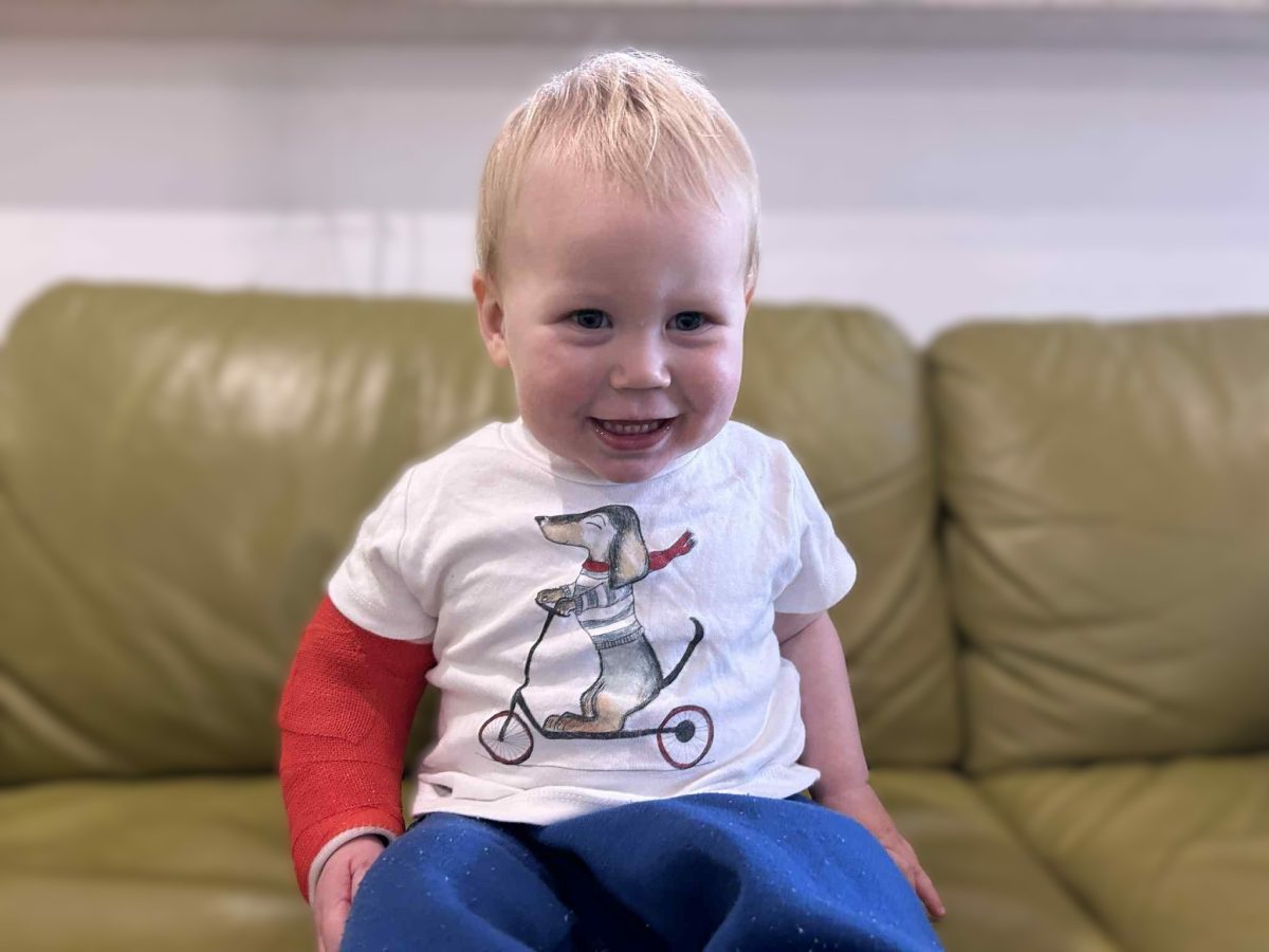 Toddler with cast on arm
